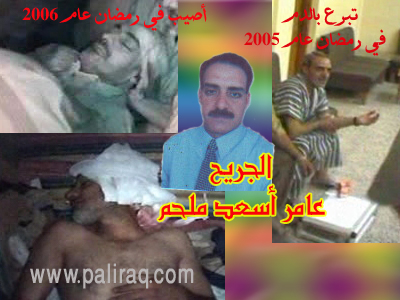الجريح عامر أسعد ملحم