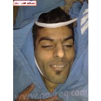 عاجل : مصرع الفلسطيني الشاب محمد أحمد عبدالواحد في سوريا جراء القصف على مخيم اليرموك